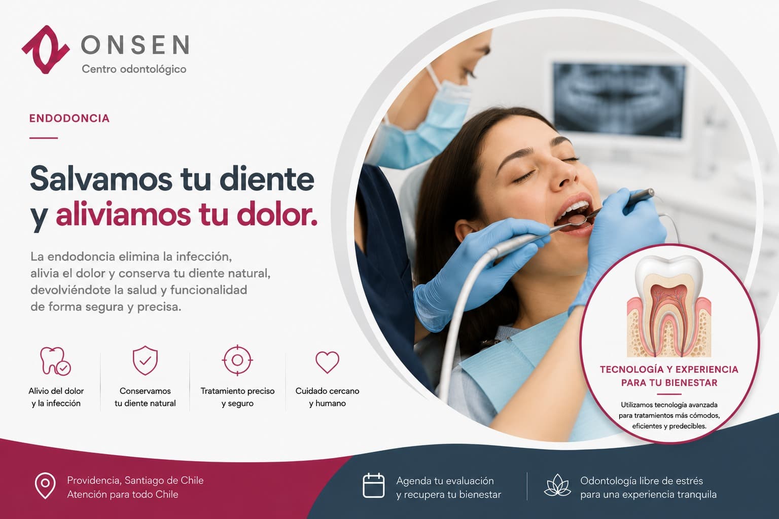 ¿Puede un tratamiento de conducto evitar un implante?